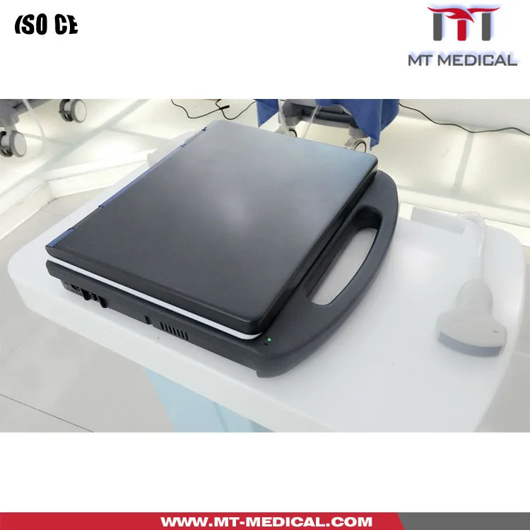 New Color Doppler Ultrasound Machine Ecografo Price Color Doplar