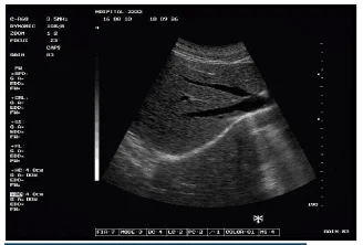 portable ultrasonic machine type 2d