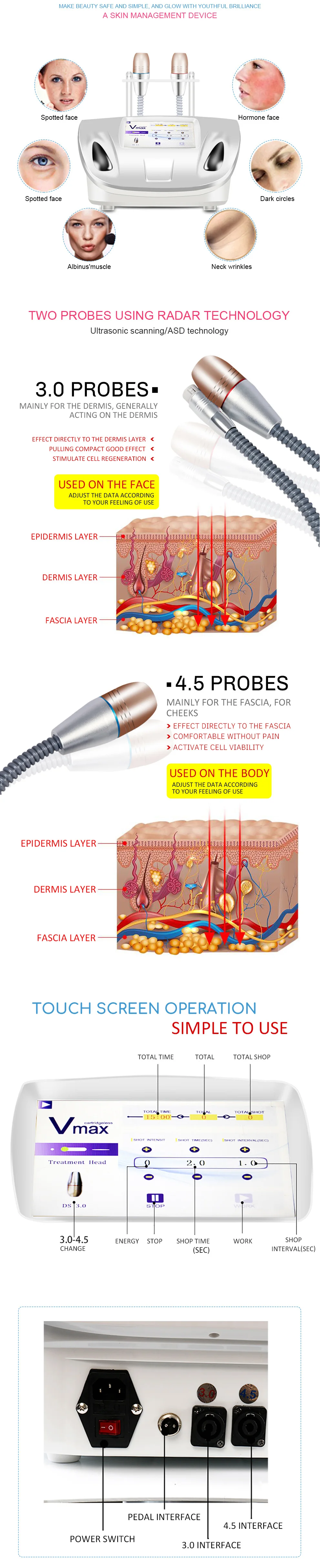 High quality V-Max anti aging beauty equipment ultrasound wrinkle remover machine for face lifting wrinkle removal