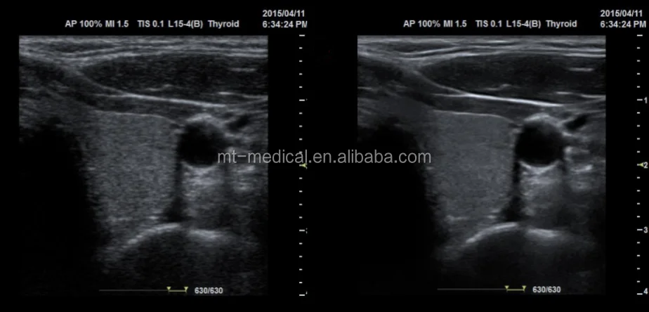Medical Ultrasound More Than Two Probe Socket Portable Scanner