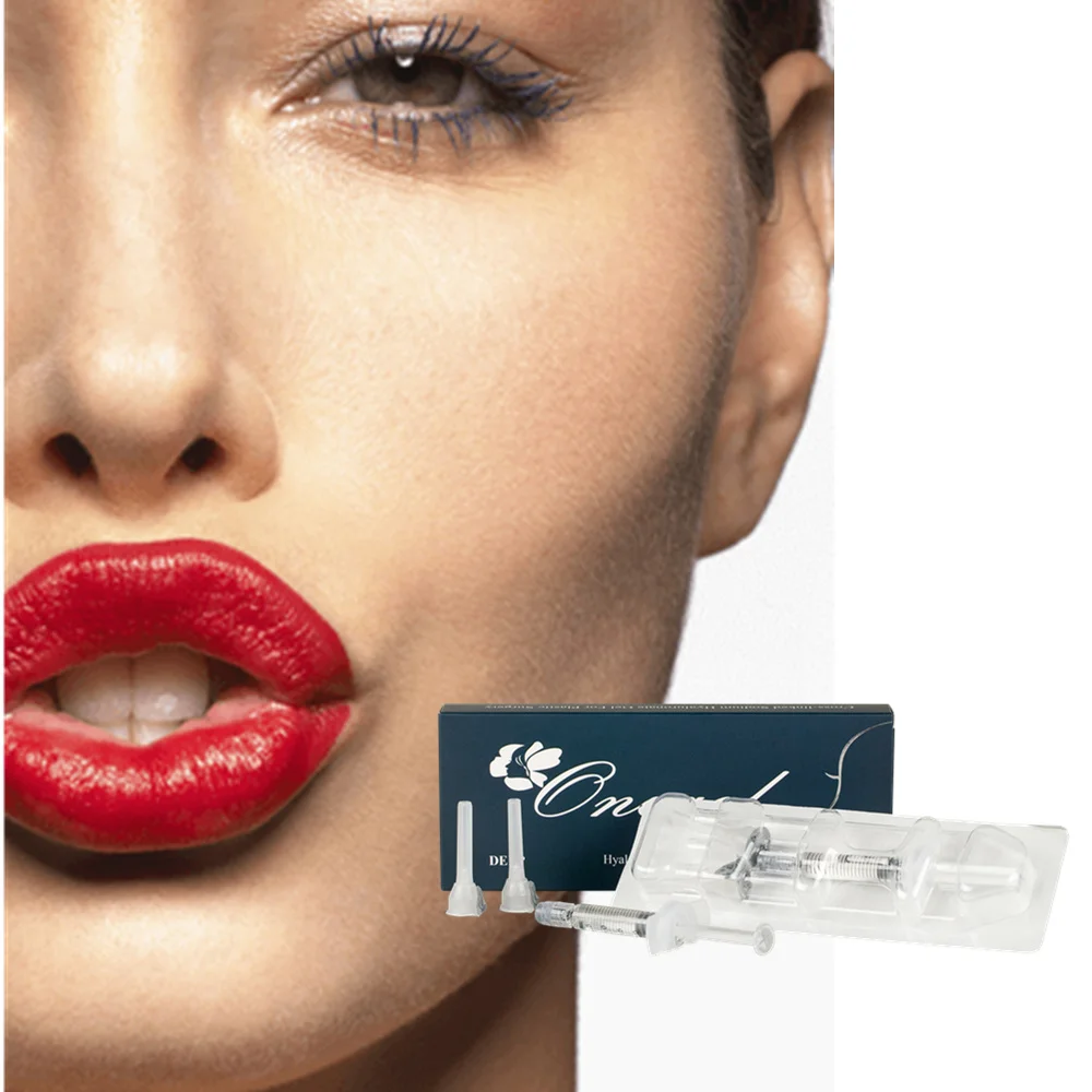 CE certified hyaluronic acid injection permanent dermal filler 2ML