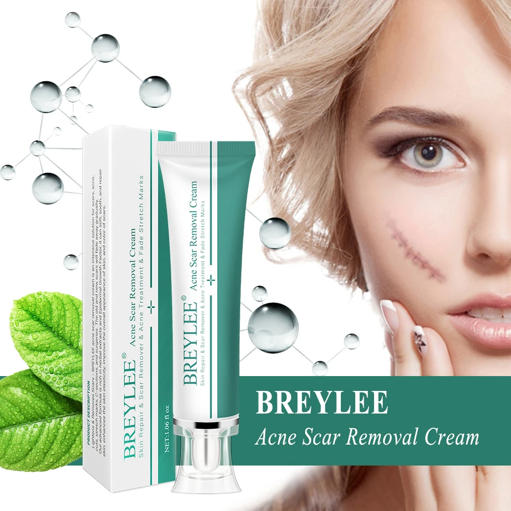

BREYLEE Private Label Acne Marks Treatment Stretch Marks Repair Acne Scar Removal Cream Free Shipping