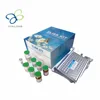 Human Angiotensin 1 Converting Enzyme,ACE1 ELISA Kit