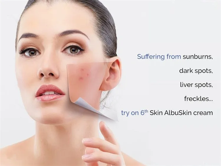 cream for hyperpigmentation on neck