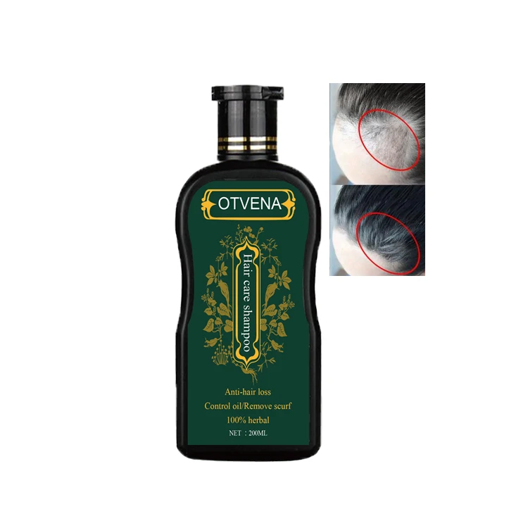 Hair Loss Hair Growth Treatment Thicker Fuller Hair Revitalizing