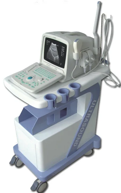 Portable Ultrasound Scanner with trolley.jpg