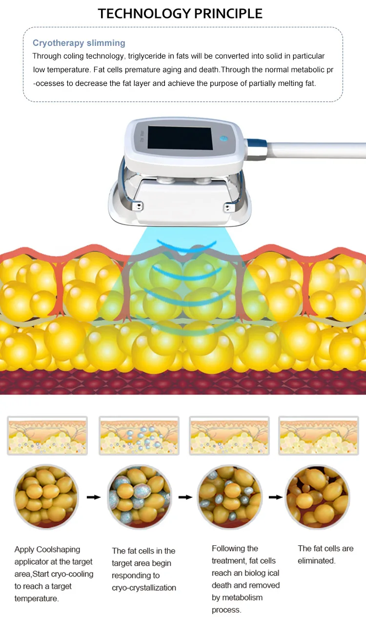 New professional fat freezing slimming cryo machine factory price