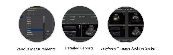 Chison Eco3 Expert Ultrasound Scanner