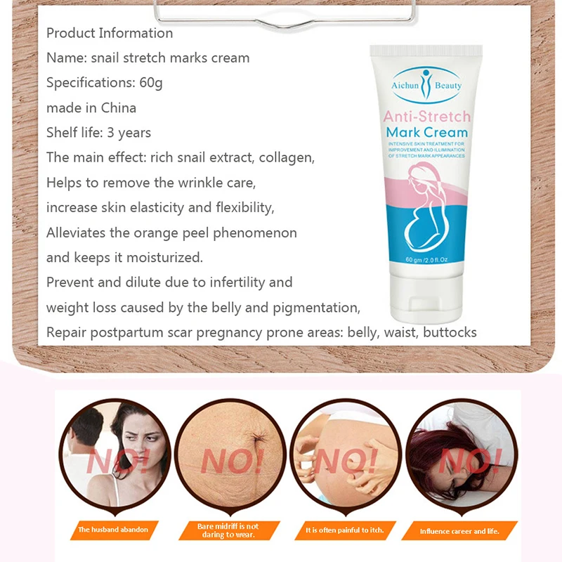 anti stretch mark cream