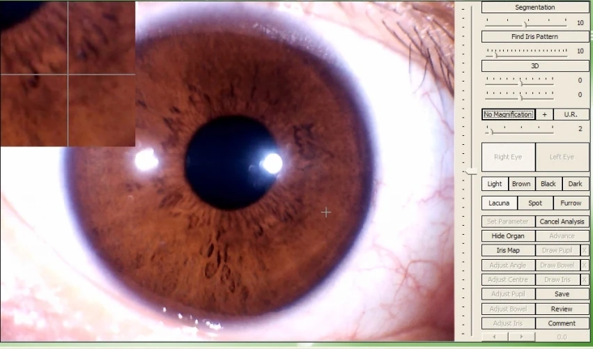 iris analyzer.jpg