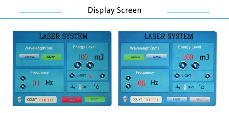 laser tattoo removal