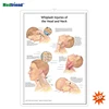 Licensed Educational Plastic 3D Medical Anatomical Wall Chart /Poster - Whiplash Injuries of the Head and Neck