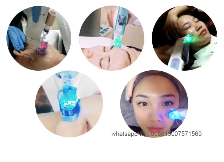 H7 radio frequency meso gun (5)