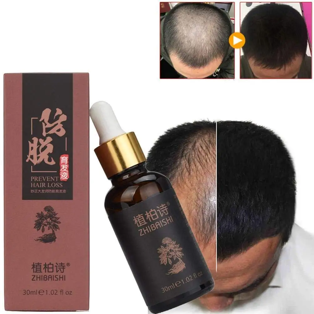 Cheap Herbal Hair Care Tips Find Herbal Hair Care Tips Deals On