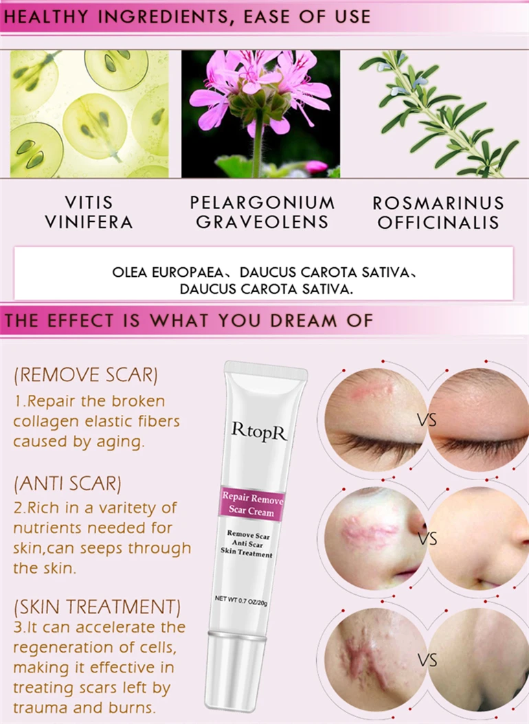repair remove scar cream