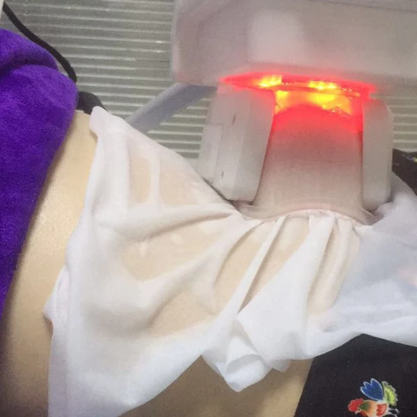 cryo gel pad anti freeze antifreeze membrane for cryolipolysis