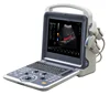 Excellent color doppler cardiac CW 4d ultrasound machine with phase array high frequency probe