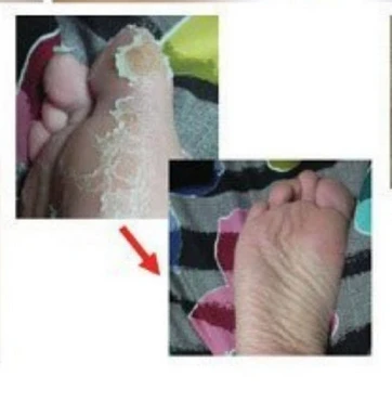 China manufacturer OEM baby feet formula foot feeling mask