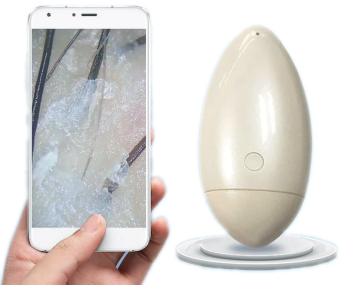 

Hot sales portable wifi hair analysis machine scalp detector, White