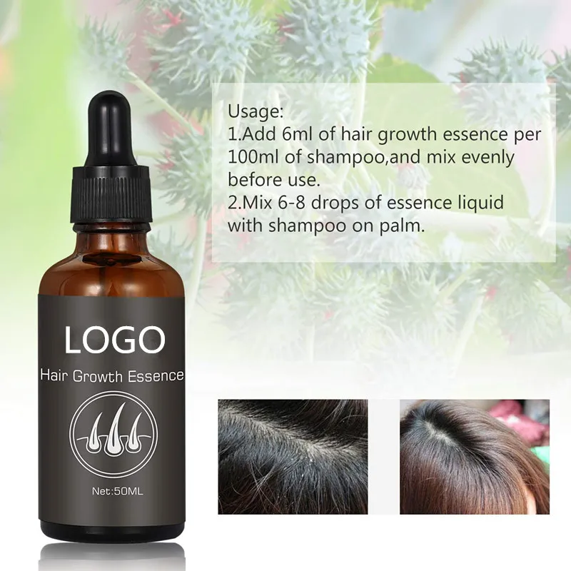 Private Label Thicker Longer Fuller Healthier Fast Hair Growth Serum ...