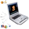 Obstetric abdomen 4D medical ultrasound machine sonography