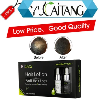 Hottest Men Hair Growth Product Best For Hair Salon Dexe Hair