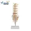 Lumbar Vertebrae Spine Anatomy Model With Sacrum Coccyx, Life Size, Medical Human Lumbar Spine Demonstration Model