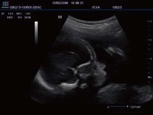 
High-quality Portable Ultrasound machine Mindray DP-50 with Diagnostic Ultrasound system for hospital 