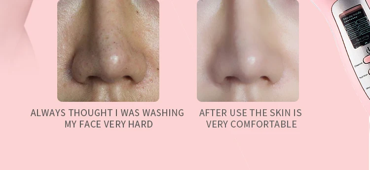 Bp-012 Whitening Skin Face Lift Fda Photon Ultrasonic Beauty Device