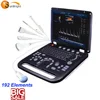 192 elements high resolution picture color doppler scanner with CE,ISO,FDA