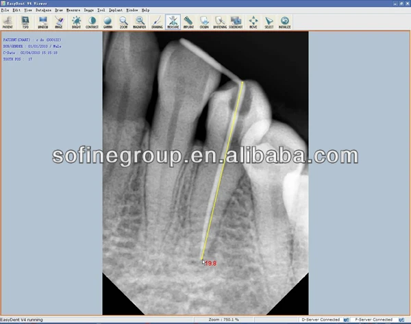kodak dental imaging software customer service number