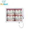 Dental intra oral camera HDMI Intraoral Camera For Dental clinic Wi-fi Intraoral endoscope 10 million pixel