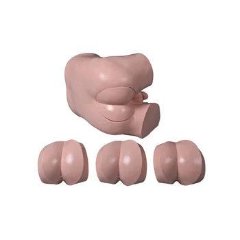 4 cm de próstata dilatada