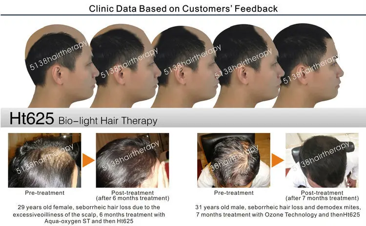 Ht625 low level cold laser therapy equipment for thinning hair growth / BIO-light treatment ( CE, ISO13485, Since1994)