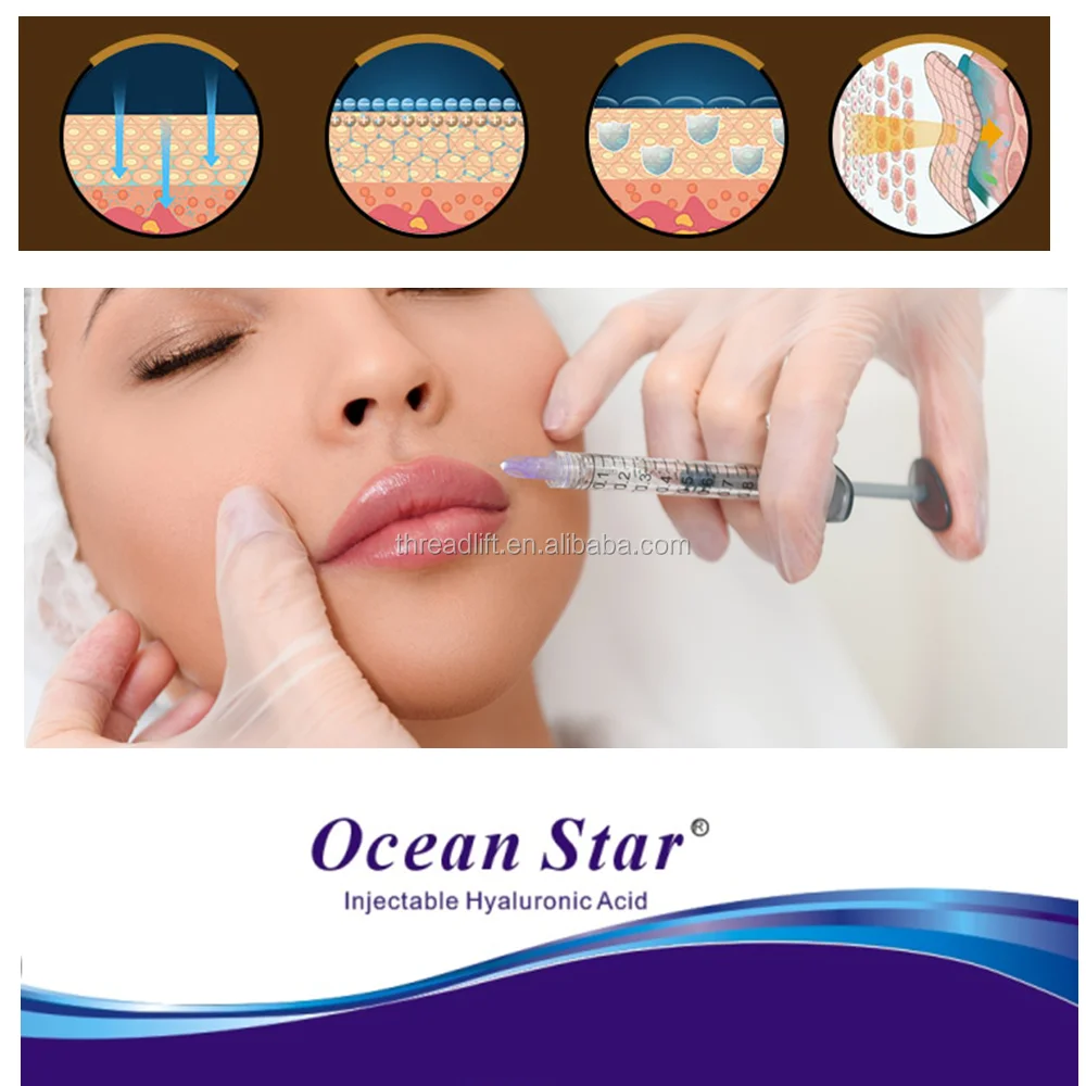 

Medical care 2ml macrolane injection filler for Lip Augmentation, N/a