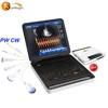 Durable quality Market qualified 128 elements 4D doppler ultrasound