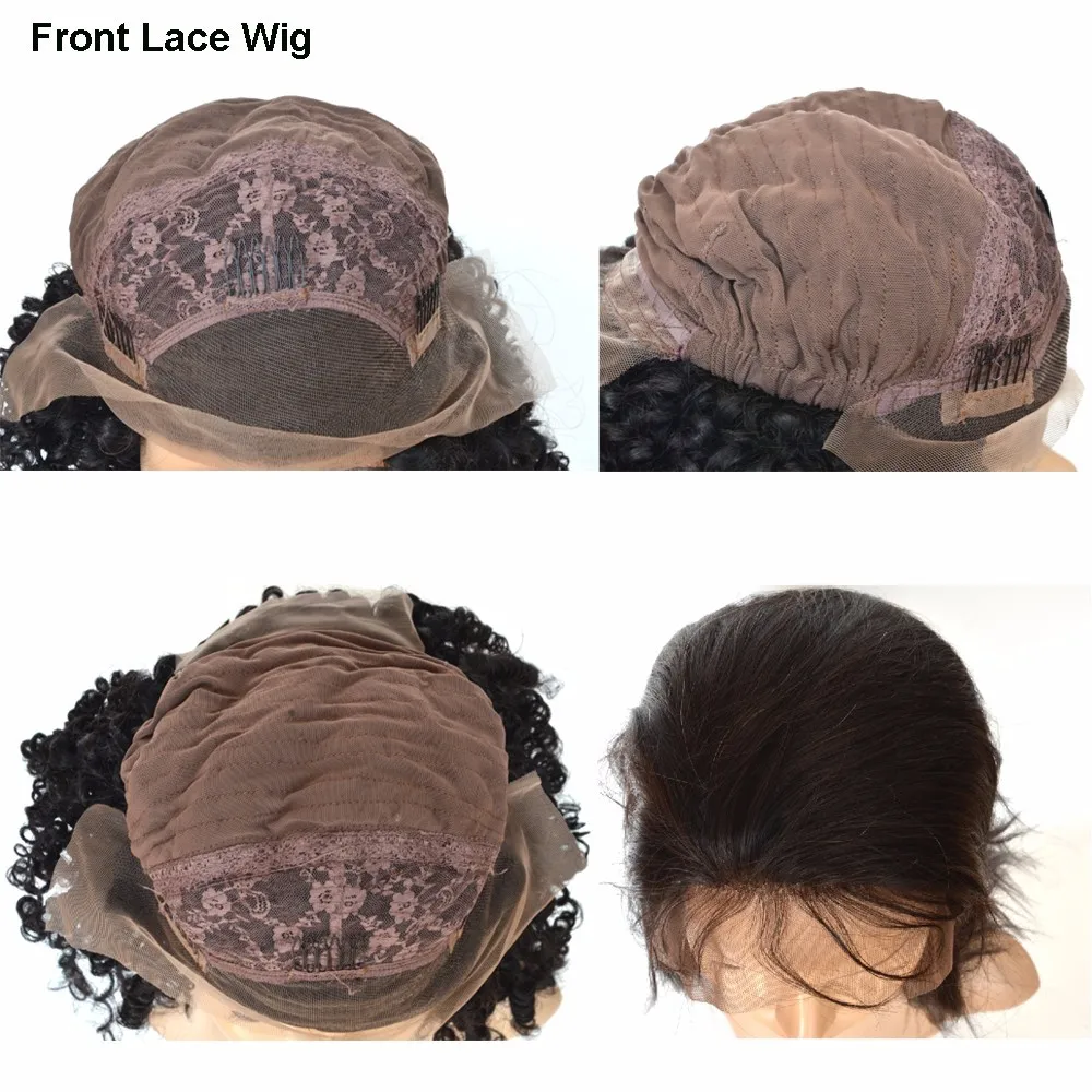 types of frontal lace