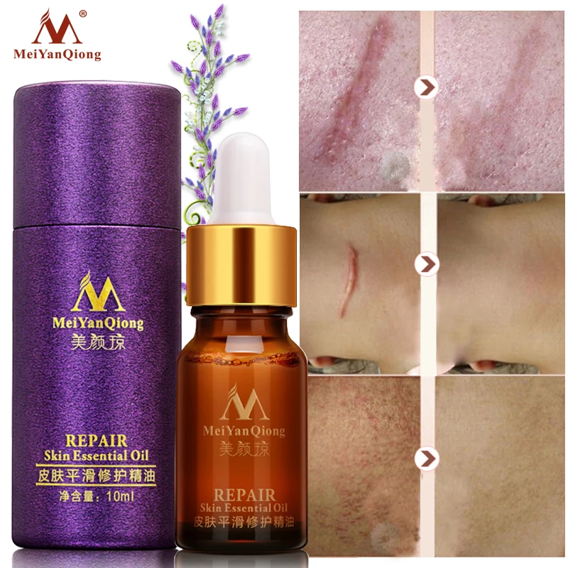 

MeiYanQiong Acne Scar Repair Natural Pure Lavender Essential Oil Professional Removal Burn Scarring Skin Repair Essential Oil