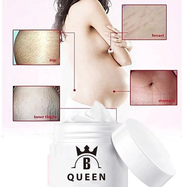 

Skin Care After Pregnancy Repairing Stretch Marks Cream Acne Scar Removal Cream