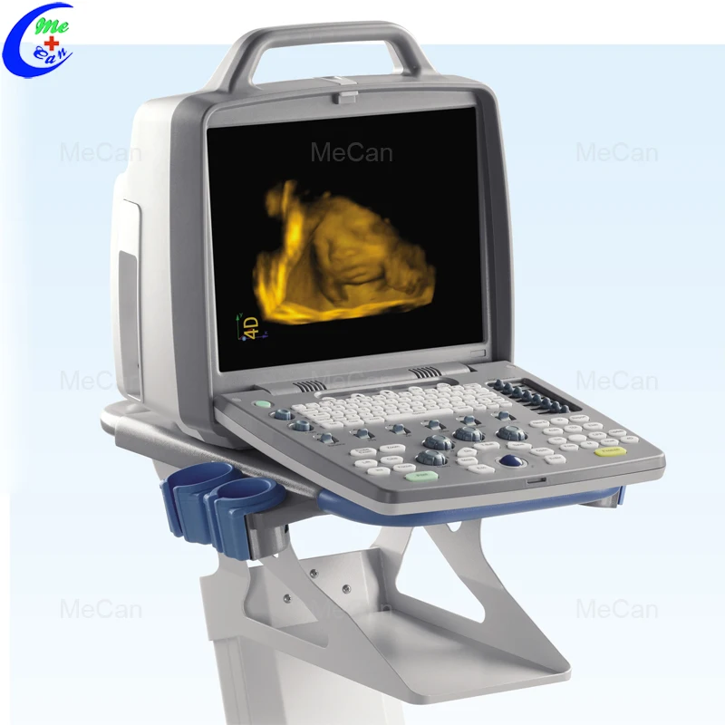 China Ecografo 4d Portable Echocardiography Machine 2d 3d View China