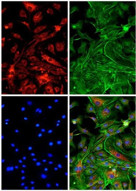 Tritc/cy3 Sets Filter Alexafluor 546 Fluorescent Probe For Fluorescence ...