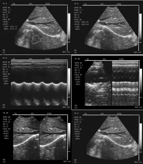 Digital Ultra Sonic Scan Ultrasound Scanner - Buy Digital Ultra Sonic ...