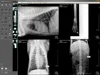 Medical Software