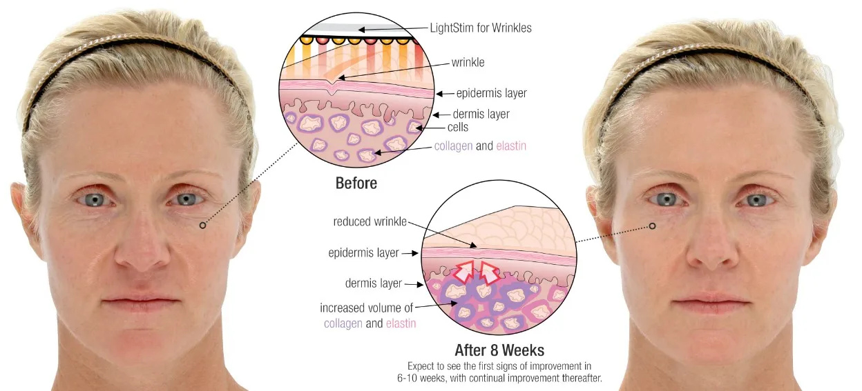 E27 24w Led Red Light Therapy Medical Device 670nm Red For Promote The