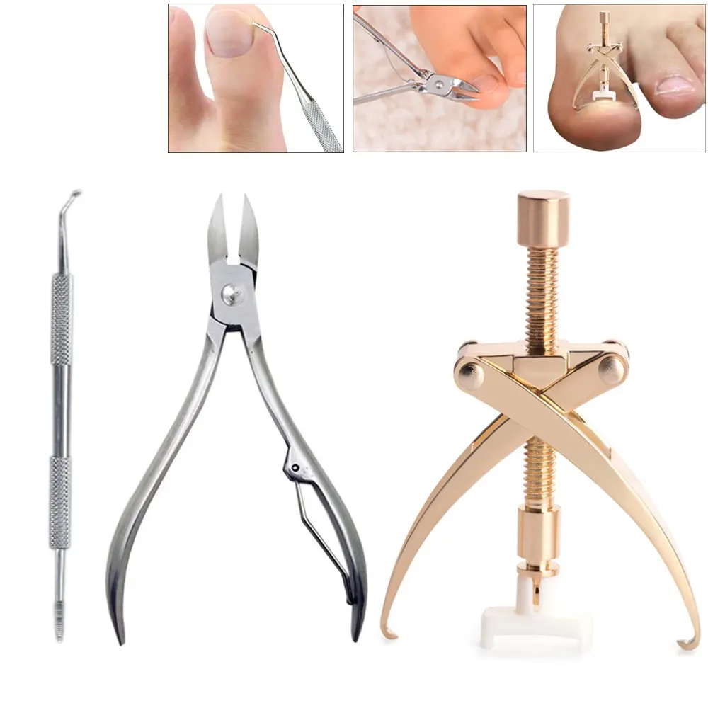 nail cutter for ingrown toenail