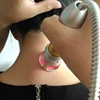 Knee Therapy Trigger Point Therapy Auto Accidents ClassIVtherapeuticlaser60w 980 810nm K laser