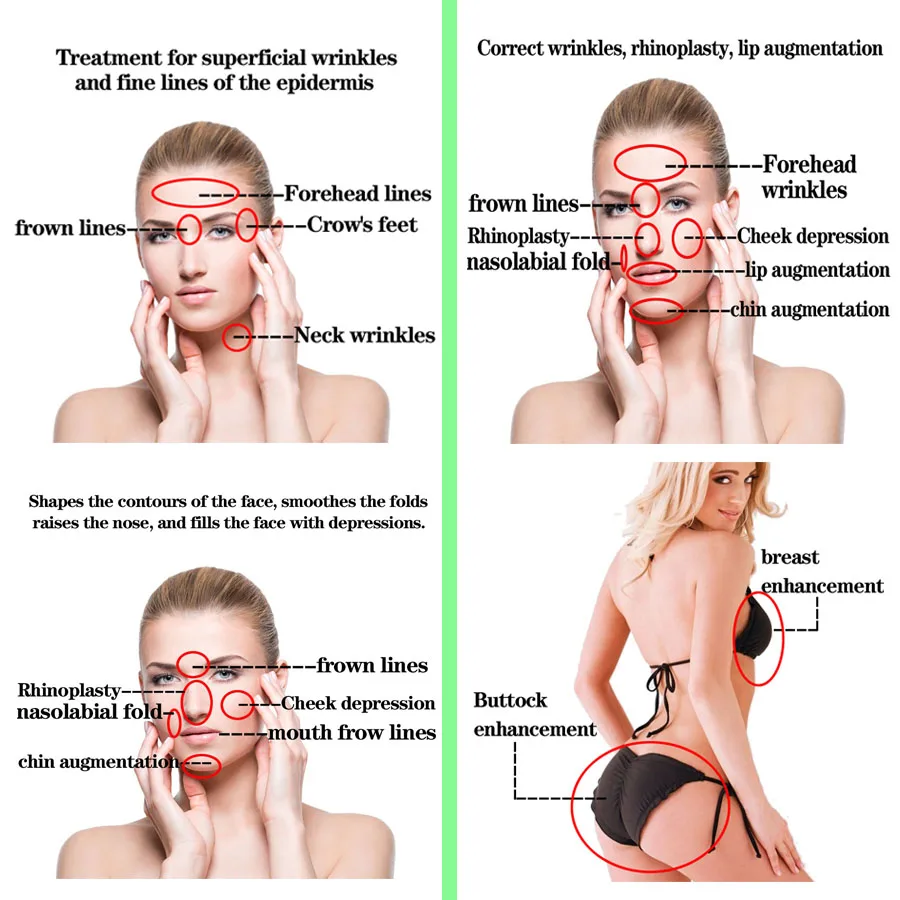 Wholesale beauty product breast filler injection hyaluronic acid gel