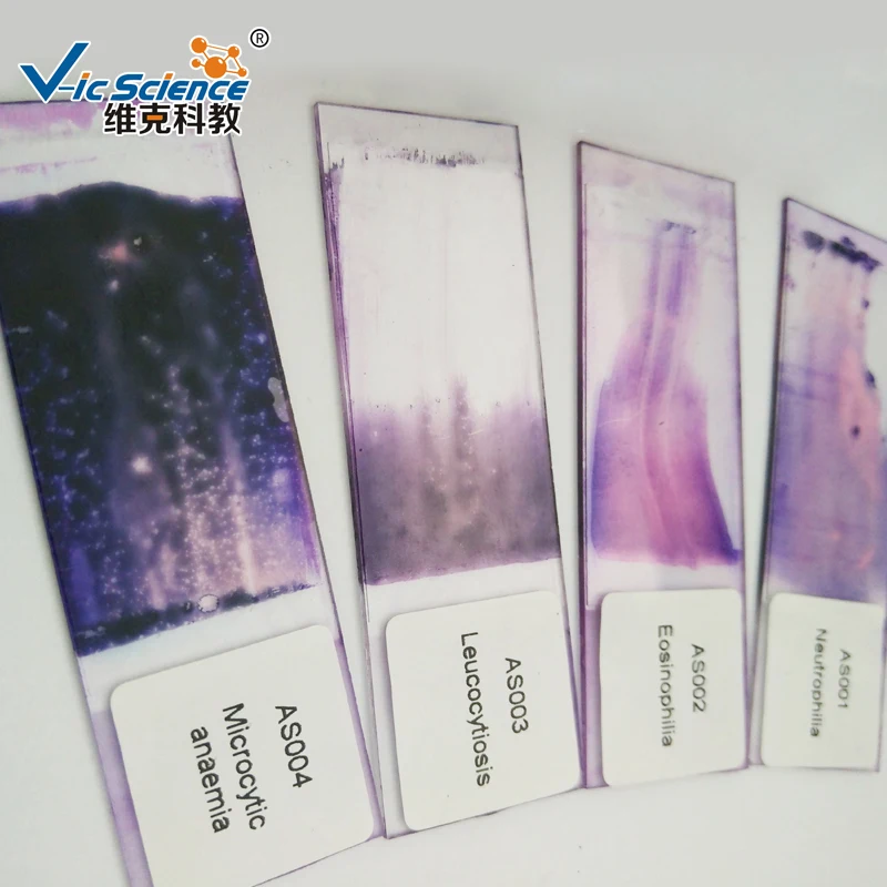 
Hematology Prepared Slides Blood Smear Prepared Slides 