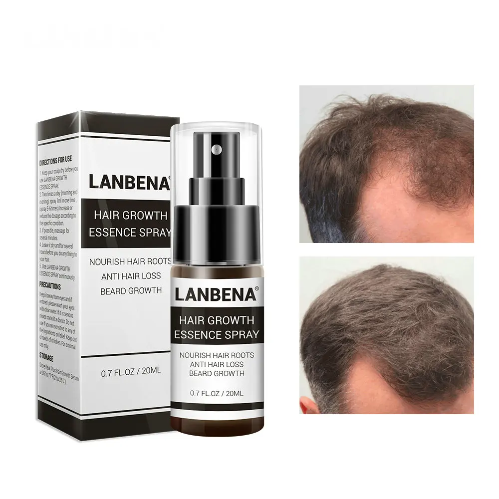 Lanbena Natural Hair Growth Essence Spray For Bald Head Buy Hair