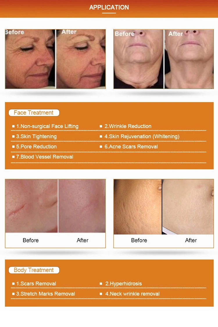 v care products for skin whitening